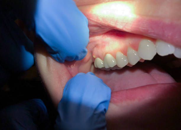 Best Pediatric Emergency Dentist in Allegan, MI