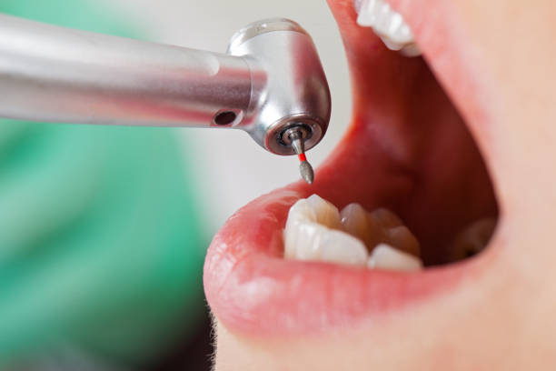Best Walk-In Emergency Dentist in Allegan, MI
